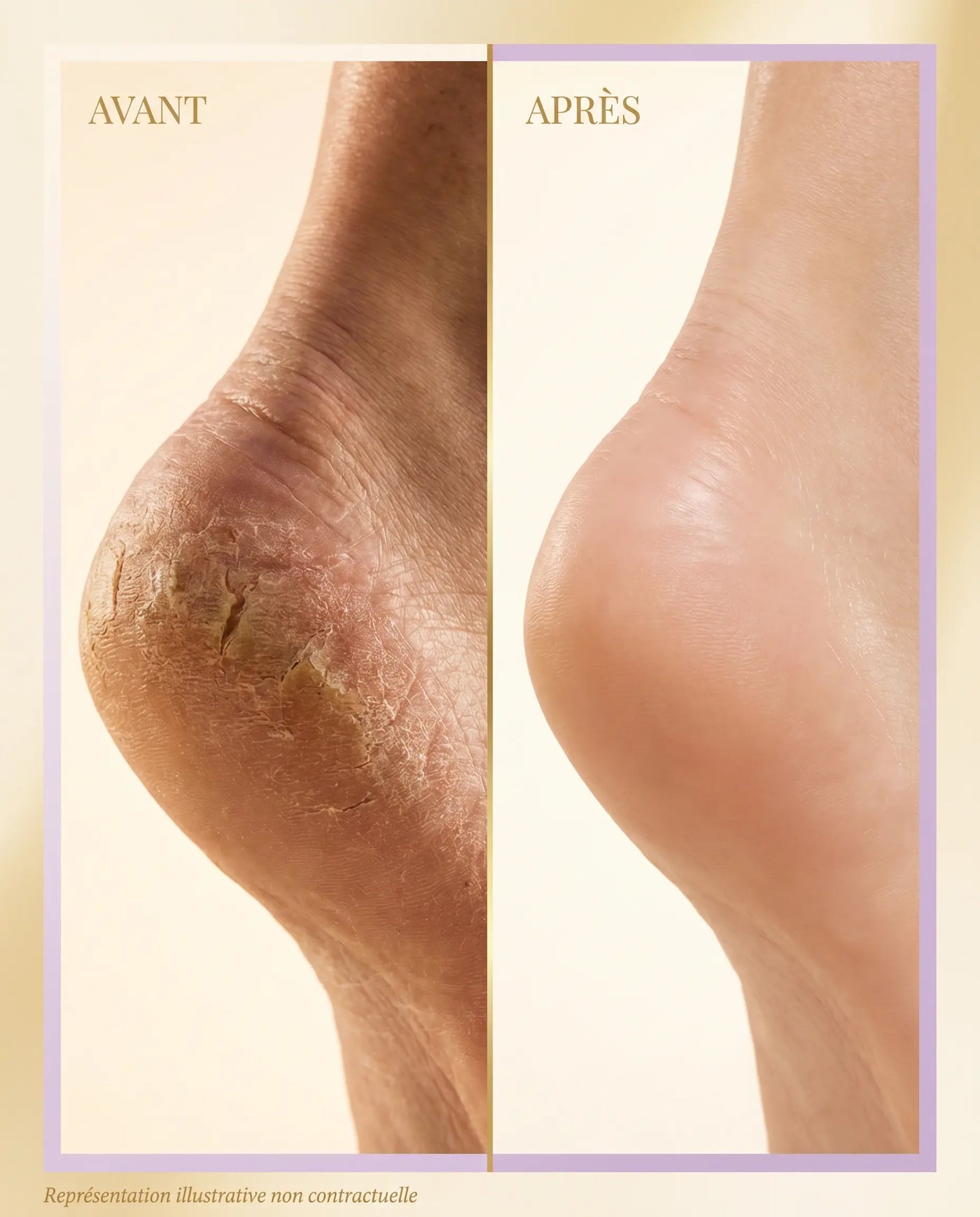 Crème Réparatrice Pieds & Talons