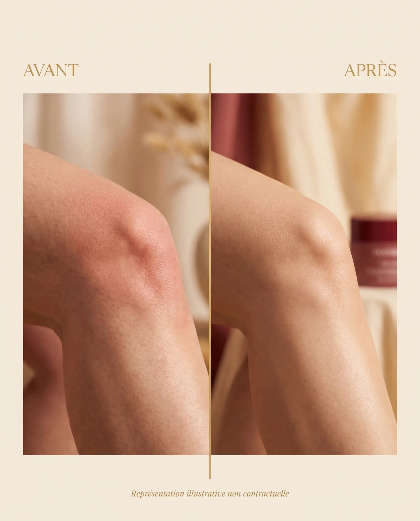 Gel Arthri Flex - Avant Après articulations (illustratif non contractuel)