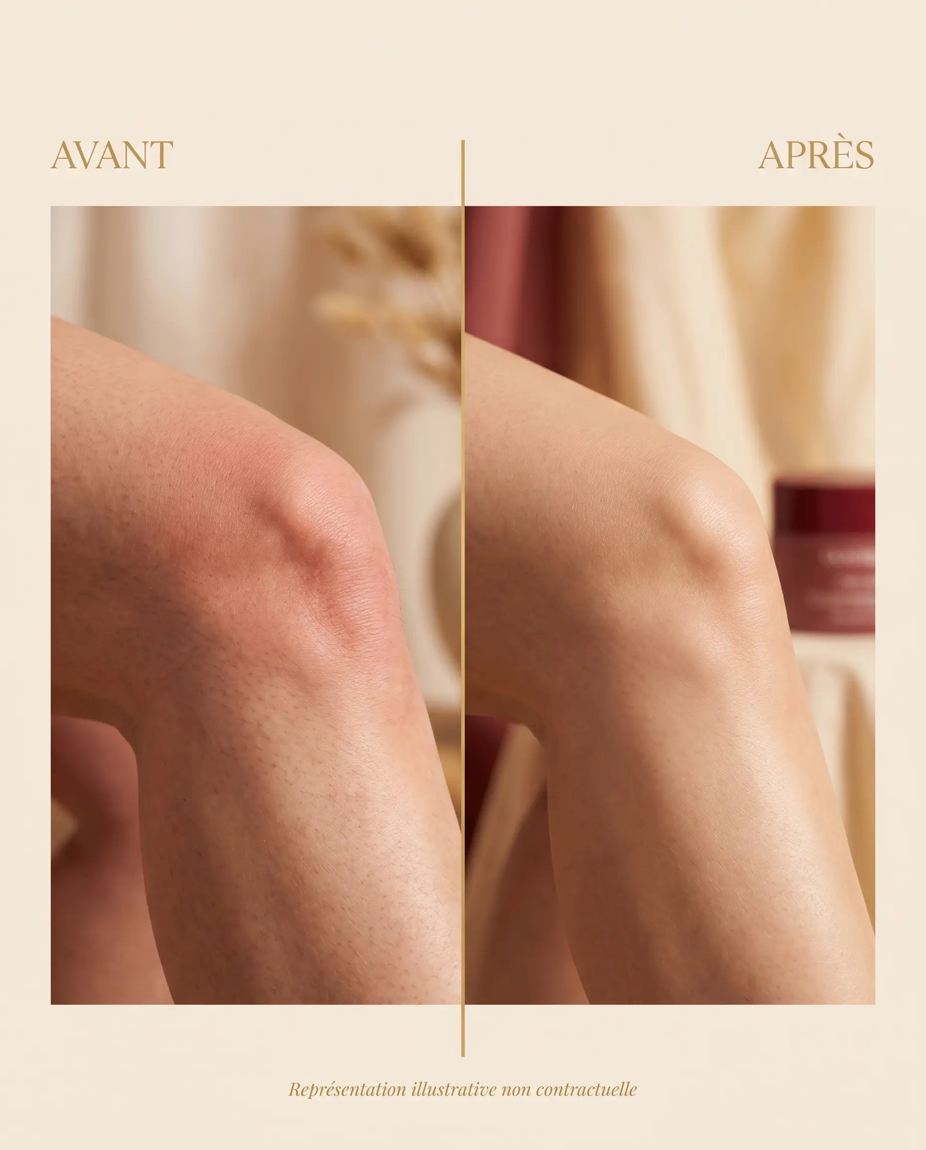 Gel Arthri Flex - Avant Après articulations (illustratif non contractuel)